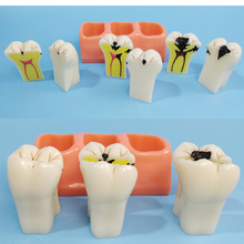 Стоматологические материалы обучающая модель патологические зубы модель стальной нефритовый Зуб модель учебное оборудование 2024 - купить недорого