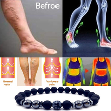 Magnet Anklet Colorful Stone eight Loss  Magnetic Therapy Bracelet Weight Loss Product Slimming Health Care jewelry 2024 - купить недорого