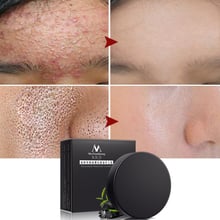 Meiyanqiong sabonete removedor de acne, removedor de cabeça preto para remoção de acne, controle de oleosidade, limpeza morta, carvão de bambu, sabonete para rosto my007 2024 - compre barato