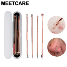 4PCS Stainless Steel Blackhead Acne Remover Needle Tool Blackhead Remover Dark Sore Acne Extractor Clean Beauty Skin Care Tool 2024 - buy cheap