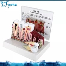 Modelo anatómico dental, compra gratis 2024 - compra barato