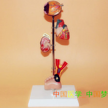 diabetes pathology model heart kidney eye model Medical Teaching free shipping 2024 - buy cheap