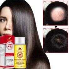 Alta quality2019 produtos de crescimento do cabelo powful gengibre mais rápido crescer shampoo cabelo parar tratamento de perda de cabelo cuidados com o cabelo 2024 - compre barato