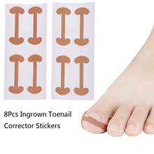 Ingrown Toe Nail Correction Sticker Patch Paronychia Corrector File Elastic Patch Corrector Foot Care Treatment Pedicure 2Sheets 2024 - buy cheap