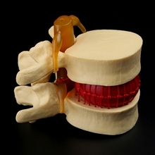 Disco Lumbar de columna anatómica, herramienta de enseñanza médica, para herniación, anatomía 2024 - compra barato