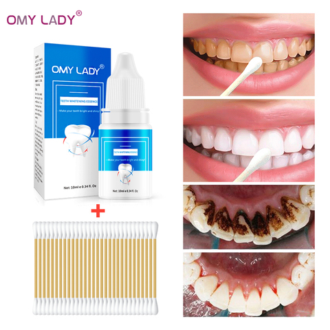 OMYLADY Teeth Whitening Essence Oral Hygiene Cleaning Serum Removes Plaque Stains Whitening Powder Dental Tools Tooth Care 2022 - buy cheap