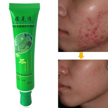 30g creme de rosto quente beleza produto rosto pele reparação acne creme controle de óleo acne removedor facial cuidados com a pele wh998 2024 - compre barato