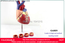 HUMAN ANATOMICAL HEART,ANATOMY VISCERA MEDICAL ORGAN MODEL EMULATIONAL ,HUMAN HEART ARTERIOSCLEROSIS MODEL -GASEN-XZ006 2024 - buy cheap