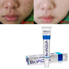 30g Anti Acne Cream Face Treatment Acne Scar Removal Cream Blemish Stretch Marks Moisturizing Face Care Skin Care 2024 - buy cheap