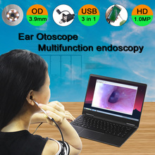 3.9mm HD 720P 3IN1 USB Medical Endoscope Ear Otoscope Camera Waterproof Endoscope Camera For OTG Android PC Ear Endoscope 2024 - buy cheap