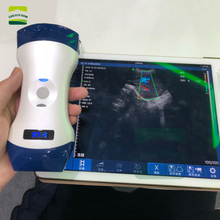 Veterinário pw cor dupla sonda sem fio ultrassom veterinário scanner portátil teste de gravidez porco cão mão ultrassom bolso cão 2024 - compre barato