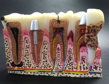 Зубные зубы общие Патологии Модель обучения модель, зубной Стоматолог для медицинской науки обучения 2024 - купить недорого