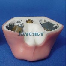 Modelo de práctica de implante Dental modelo mandibular simulación de modelo de enseñanza 2024 - compra barato