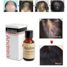 BellyLady 20 мл натуральная эссенция для быстрого роста волос масло для роста волос сывороточное масло 2024 - купить недорого