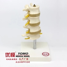 Human medical bone model Normal lumbar spine model natural size free shipping 2024 - buy cheap