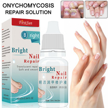 High Quality 10ml Nail Fungal Treatment Anti Fungus Onychomycosis Removal Toenail Care Nails Repair Liquid 2024 - buy cheap