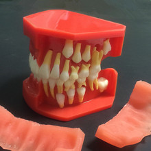 2018 boa qualidade nova chegada modelo anatomia dentária dentária modelo infantil 2024 - compre barato