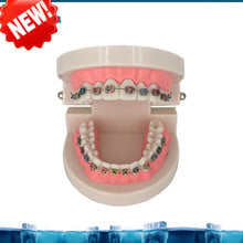 Dental Orthodontic Treatment Model Typodont With Ortho Metal Ceramic Bracket Arch Wire Buccal Tube Ligature Ties teeth model 2024 - buy cheap