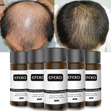 Эссенция для роста волос, эфирное масло для лечения выпадения волос, сыворотка для роста густых волос 2024 - купить недорого
