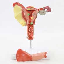 1:1 modelo anatômico do úsculo humano, modelo patológico de ovário, modelo anatômico do úsculo feminino, modelo reprodutor 2024 - compre barato