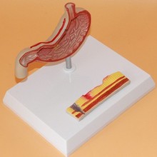 stomach Disease Anatomical Model Gastroenterology human Digestive System model Medical Teaching free shipping 2024 - buy cheap