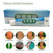 Pomada com venia variante sophora, medicamento natural de ervas chinês 20 tamanhos para tratamento de vascular 2024 - compre barato