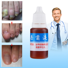 5 ml Creme de Tratamento de Fungos Nas Unhas Onicomicose Paroníquia Anti Infecção Fúngica das Unhas Mata As Bactérias e Fungos 2024 - compre barato