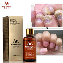 Fungal Nail Treatment Essence Nail And Foot Whitening Toe Nail Fungus Removal Feet Nail Care Essential Oil 2024 - buy cheap