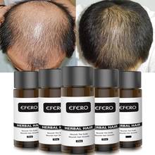 Efferent мощный сыворотка эфирное масло для роста волос, чтобы предотвратить выпадение волос профессиональные продукты для волос растут толще 2024 - купить недорого