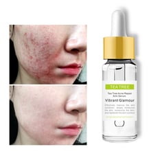 VIBRANT GLAMOUR Acne Treatment Serum Face Facial Essence Acne Scar Removal Cream Whitening Repair Pimple Remover TSLM1 2024 - buy cheap