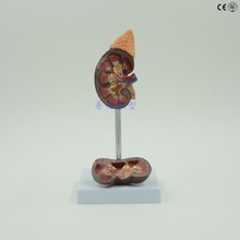 Modelo anatómico de riñón humano, sistema urinario, suministros de enseñanza de ciencia médica 2024 - compra barato