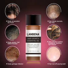 LANBENA Fast Powerful Hair Growth Essence Products Essential Oil Liquid Treatment Preventing Hair Loss Hair Care Andrea 20ml 2024 - buy cheap