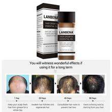 Эссенция для роста волос LANBENA, 20 мл, быстрое мощное средство для ухода за волосами, эфирное масло, жидкое лечение, для предотвращения выпадения волос для мужчин и женщин 2024 - купить недорого