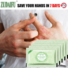 10Pcs/Lot zudaifu Body Psoriasis Ceam China Creams Psoriasis Ointment Massage Body Cream 2024 - buy cheap