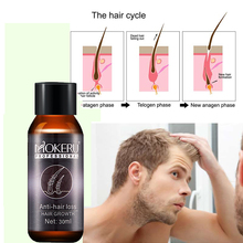 Mokeru 30ml Natural Anti Hair Loss Products Vitamins Wild Growth Castor Oil Hair Serum Oil For Hair Growth Agent Care Treatment Buy Cheap In An Online Store With Delivery Price Comparison