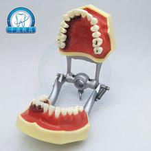 Стоматологическое обучение патологии пародонта модель зуба практика лечение зубного камня 2024 - купить недорого