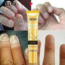 Nail Fungus Treatment Nail Foot Protector Skin Care Cream Herb Nails Repair Cream Nail Tool 15g Herb Nail Growth Oil Care TSLM1 2024 - buy cheap
