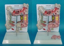 Modelo de estrutura mórbida do cólon do intestino grosso exibição do trato digestivo humano anorretal retal modelo duodeno 2024 - compre barato