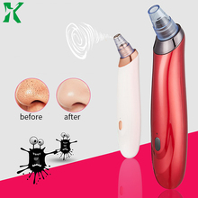 Electric Blackhead Remover Pore Cleaner Skin Care Blackhead Acne Removal Vacuum Suction Tool Face Dermabrasion Clean Machine 2024 - buy cheap