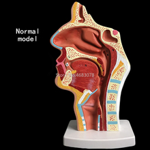 Normal/pathological Anatomy model of the nasopharyngeal cavity in the nasal cavity and throat of human body 24x12x12cm 2024 - buy cheap