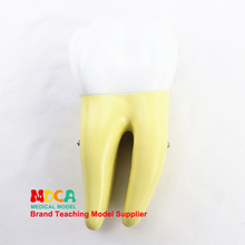 Modelo molar humano, exhibición dental, modelo de enseñanza de odontología, demostración MYC007 2024 - compra barato