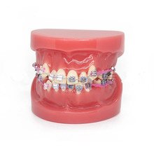 Modelo de tratamiento de maloclusion para ortodoncia Dental, con soportes de cerámica, alambre de cadena para enseñanza de ciencia médica, nuevo de 2018 2024 - compra barato