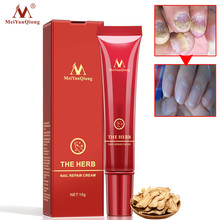 MeiYanQiong Herbal Nail Treatment Onychomycosis Paronychia Anti Fungal Nail Infection Toe Nail Fungus Treatment 15ml 2024 - buy cheap