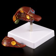Human Liver Pathological Anatomical Model Anatomy School Medical Teaching Display Tool Lab Equipment 2024 - buy cheap