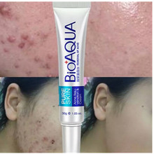 1pc Skin Care 30g Acne Treatment Blackhead Remova Anti Acne Cream Oil Control Shrink Pores Acne Scar Remove Face Care Whitening 2024 - buy cheap