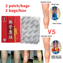 Spider Veins Varicose Treatment Plaster Varicose Veins Cure Patch Vasculitis Natural Solution Herbal Plaster Patches 2024 - buy cheap