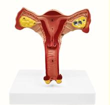 Модель планирования женской репродуктивной системы анатомии матки, модель медицинского обучения, бесплатная доставка 2024 - купить недорого
