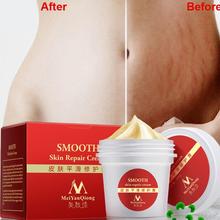 Maternity Skin Repair Body Cream For Stretch Marks Scar Removal Remove Scar Care Postpartum Regnancy Serum Smooth Skin Cream 80g 2024 - buy cheap
