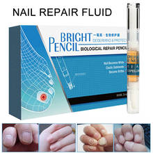 New Arrival 3ml Nail Onychomycosis Treatment Solution Nail Fungus Treatment Liquid Anti Fungal Toenail Fingernail Nails Repair 2024 - buy cheap