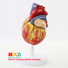 Cardiovascular Medicine Teaching MXZ004 for Human Four-Component Two-fold Large Cardiac Anatomical Model 2024 - buy cheap